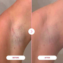 Charger l'image dans la galerie, 1x EpiLuxe